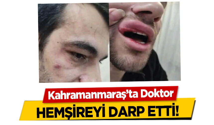 Kahramanmaraş’ta Doktor, hemşireyi darp etti!