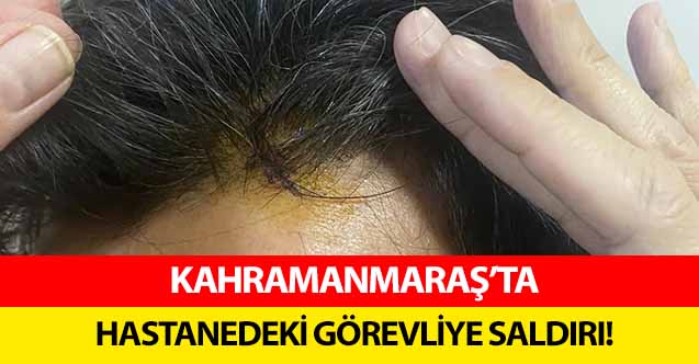 Kahramanmaraş’ta hastanedeki görevliye saldırı!