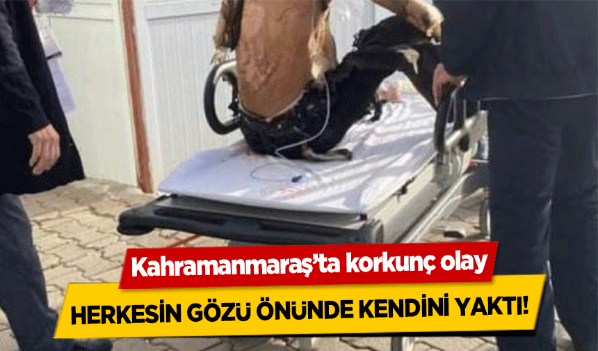 Kahramanmaraş’ta kendini ateşe verdi