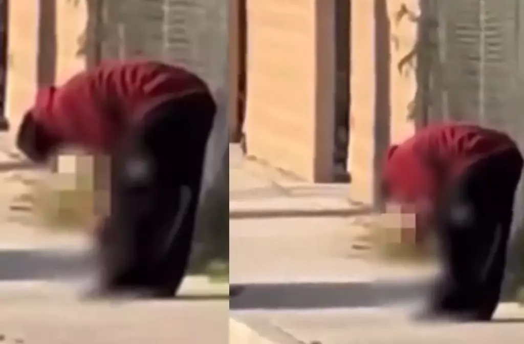 Kaldırımda bulduğu insan bacağını yedi! Dehşet olay
