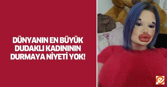 Dünyanın en büyük dudaklı kadınının durmaya niyeti yok!