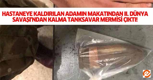 Hastaneye kaldırılan adamın makatından ıı. Dünya savaşı'ndan kalma tanksavar mermisi çıktı!