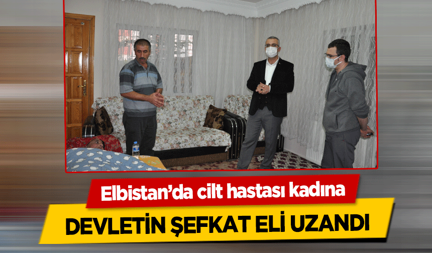 Elbistan’da cilt hastası kadına devletin şefkat eli uzandı