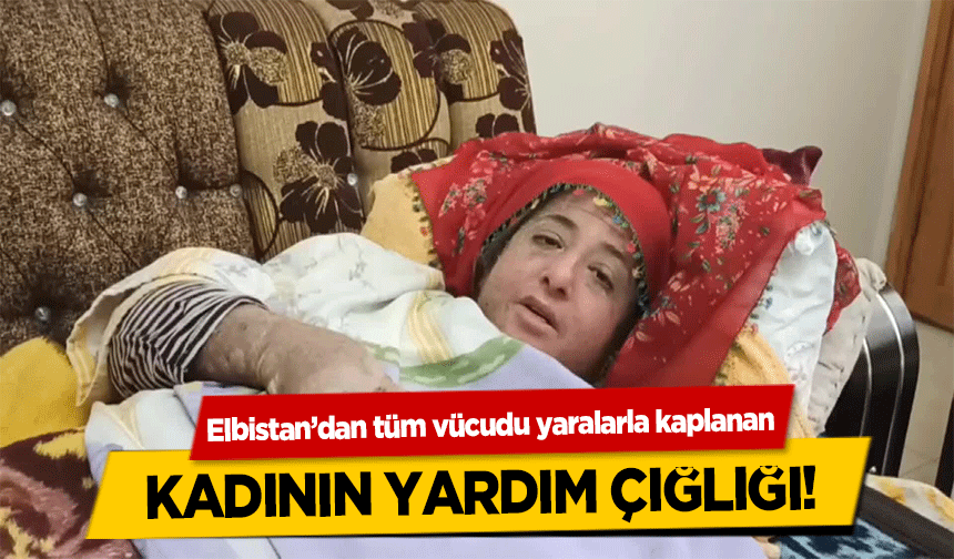 Elbistan’dan tüm vücudu yaralarla kaplanan kadının yardım çığlığı!